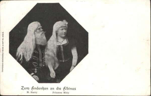 Kuriosum Albinos M. Harry Prinzess Mitty
